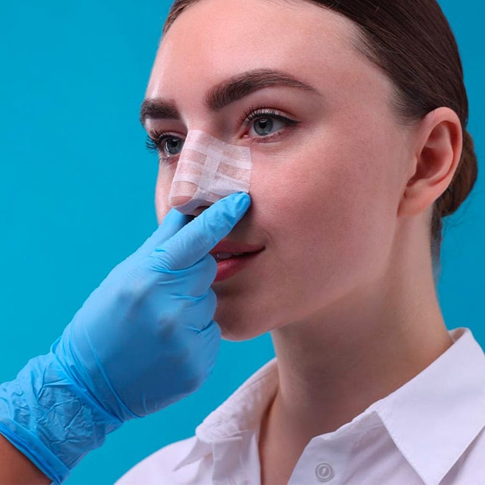 deuxieme rhinoplastie secondaire fonctionnelle chirurgie du nez operation esthetique du nez rhinoplastie chirurgie plastique chirurgien esthetique paris dr frederic picard