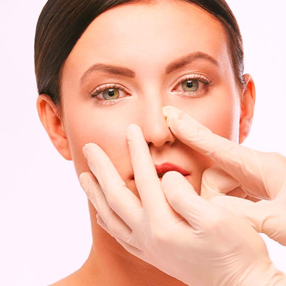 nez tordu nez devie nez asymetrique chirurgie du nez operation esthetique du nez rhinoplastie chirurgie plastique chirurgien esthetique paris dr frederic picard