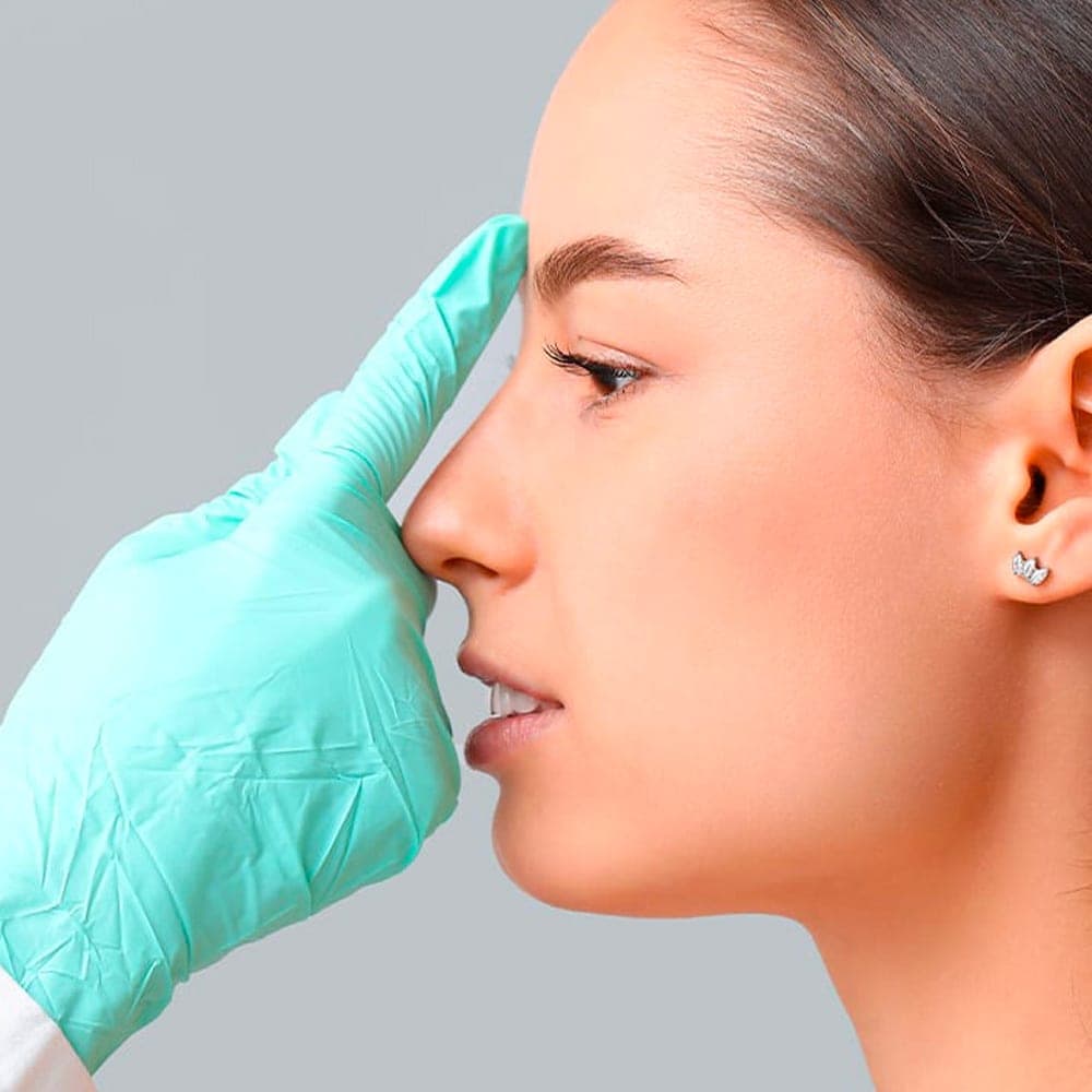 rhinoplastie voie fermee chirurgie du nez operation esthetique du nez rhinoplastie chirurgie plastique chirurgien esthetique paris docteur frederic picard